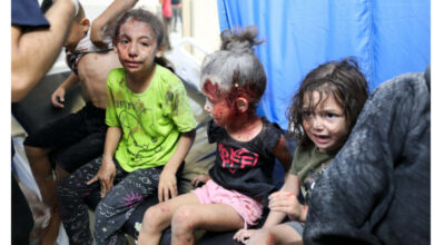 Photo of يونيسف: إصابات الأطفال جراء الحرب في قطاع غزة “مروعة”